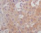 Anti-beta Tubulin Mouse Monoclonal Antibody